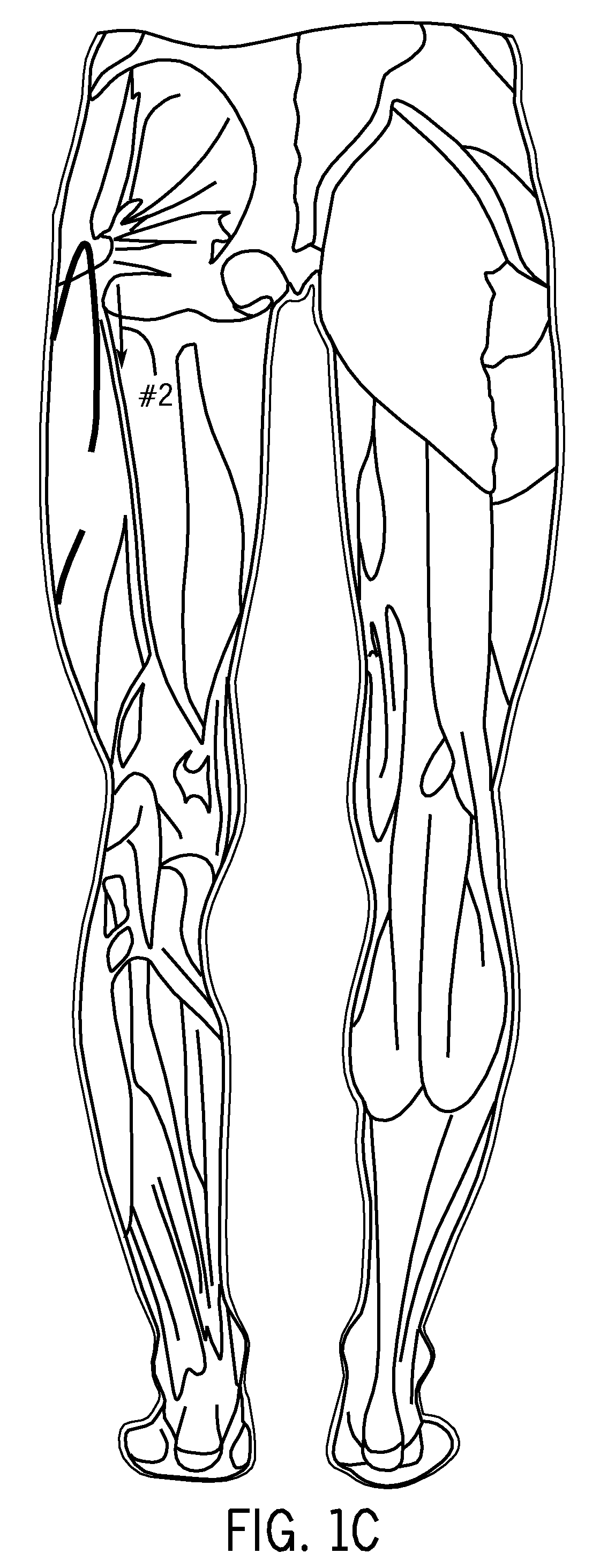 Cutaneous proprioreceptive activation garment system