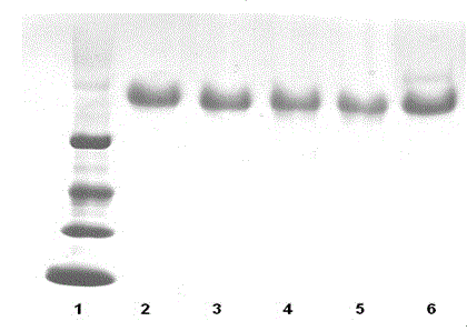 A kind of pegylated interferon injection and preparation method thereof