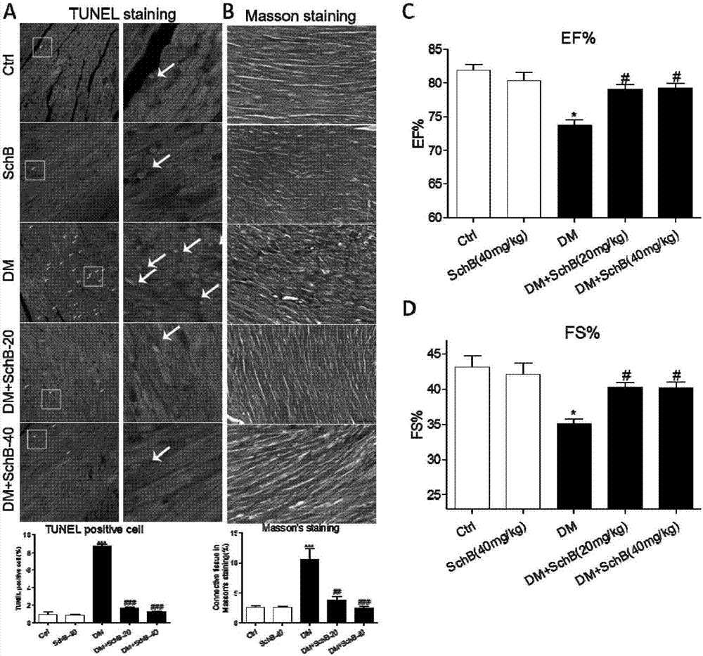 Application of schisandrin B in drug preparation