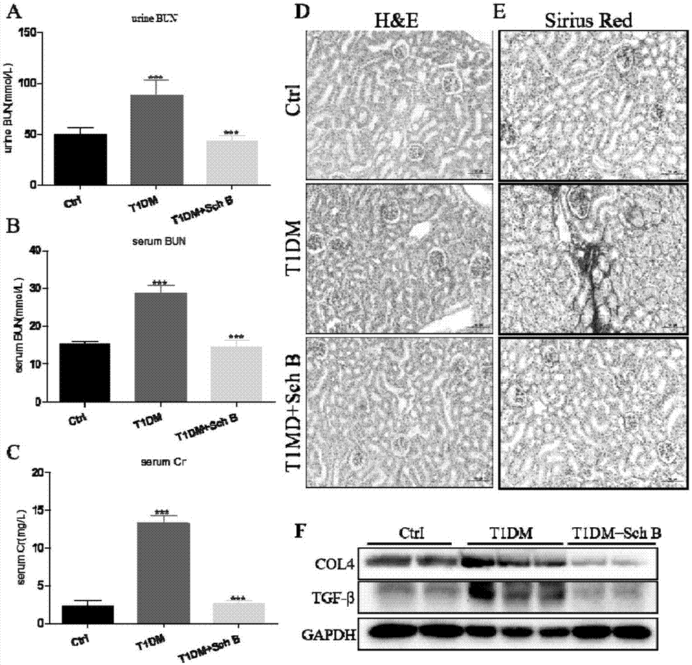 Application of schisandrin B in drug preparation