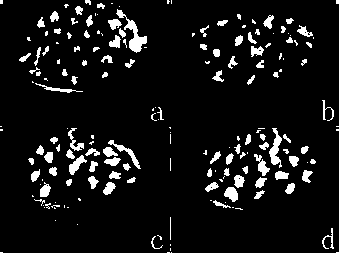 Peanut breeding method of fast neutron irradiation combining with tissue culture