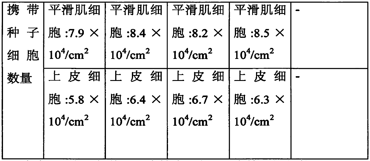 Tissue engineering urethra stent and preparation technology thereof