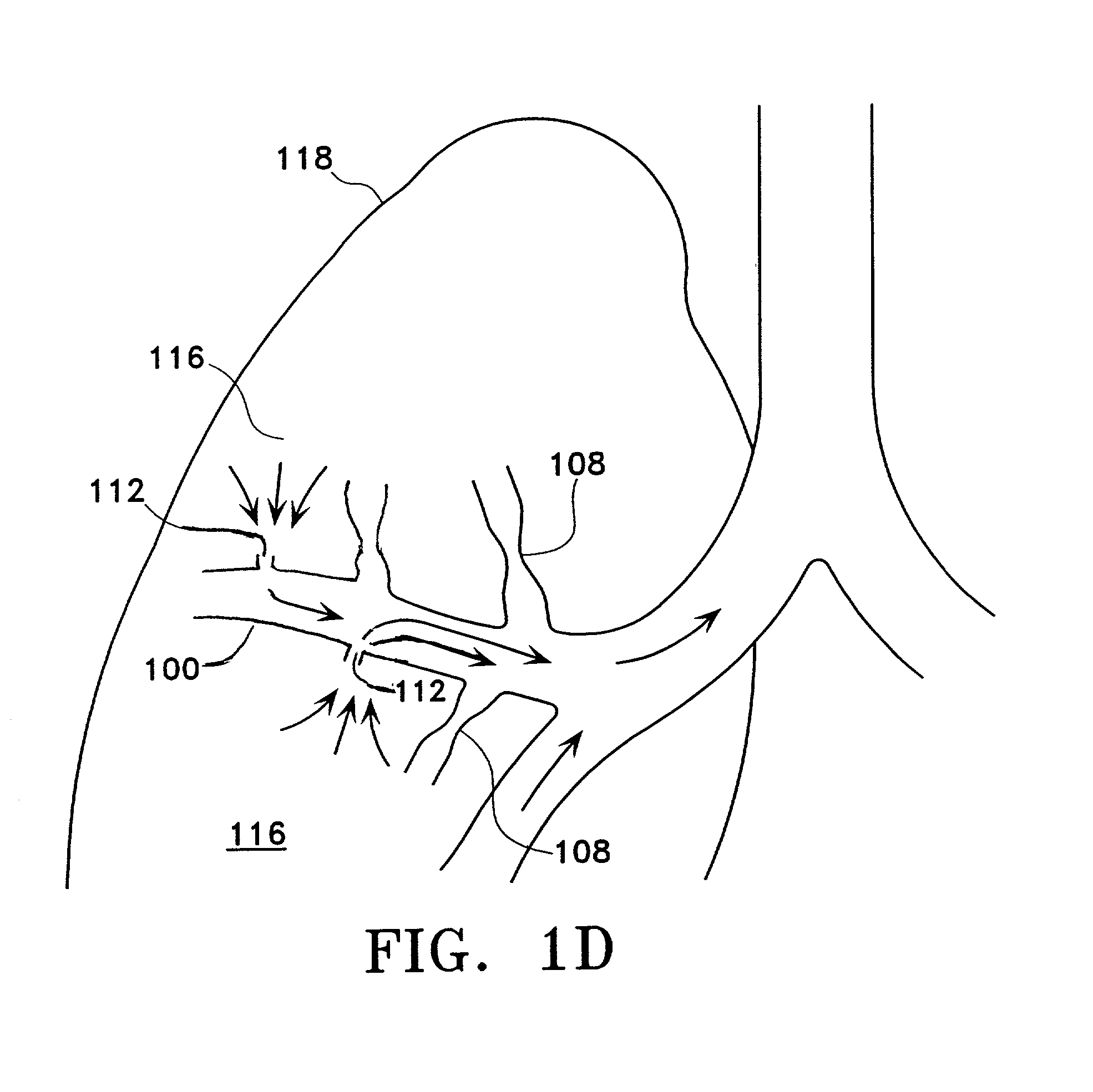 Devices for applying energy to tissue