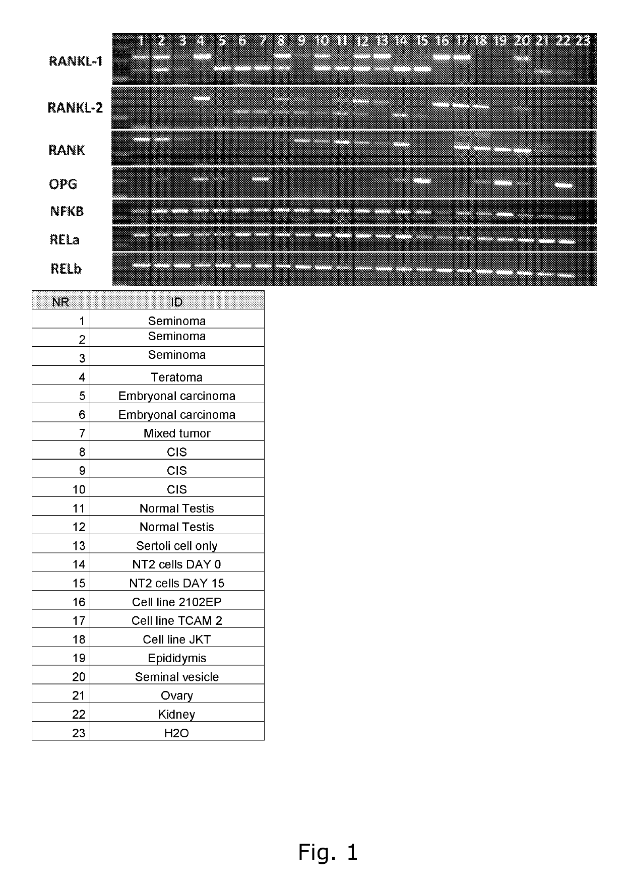 Antibodies, compounds and derivatives thereof for use in the treatment of male infertility