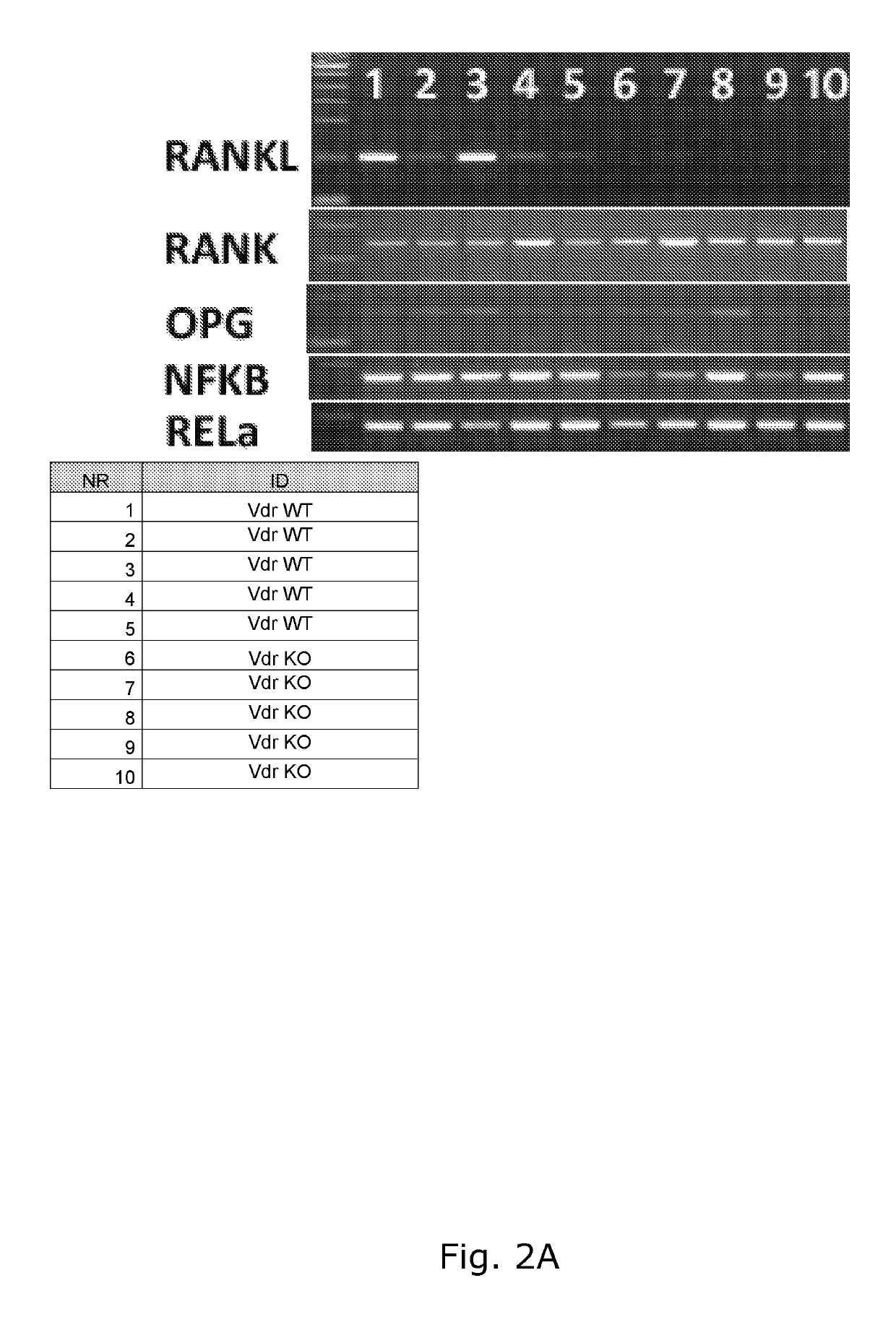 Antibodies, compounds and derivatives thereof for use in the treatment of male infertility