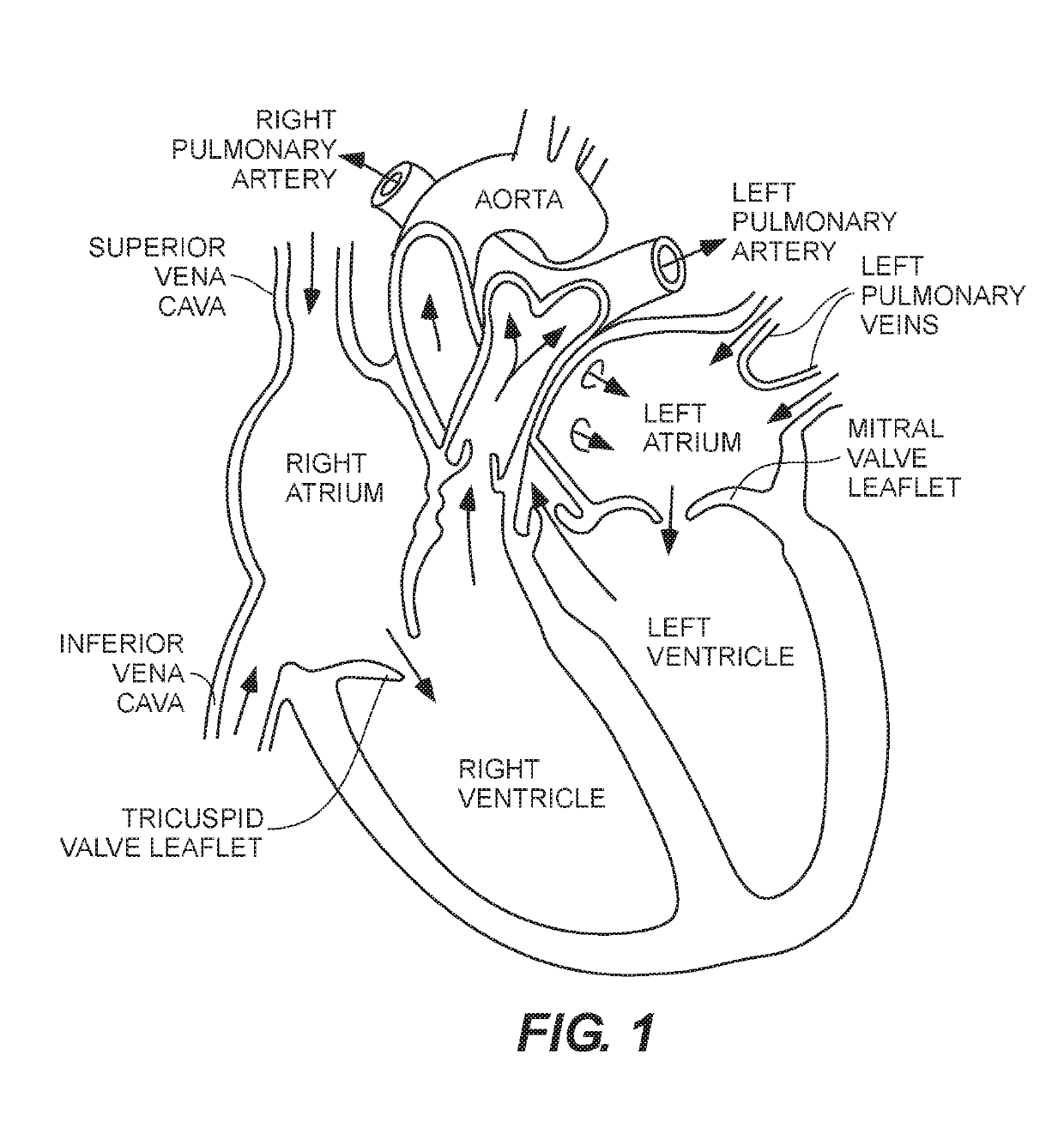 Expandable frames and paravalvular leak mitigation systems for implantable prosthetic heart valve devices