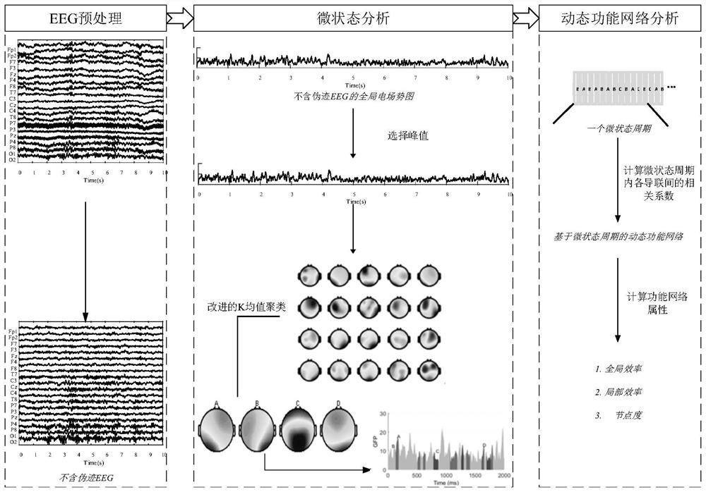 Dynamic brain function network generation method, system and equipment