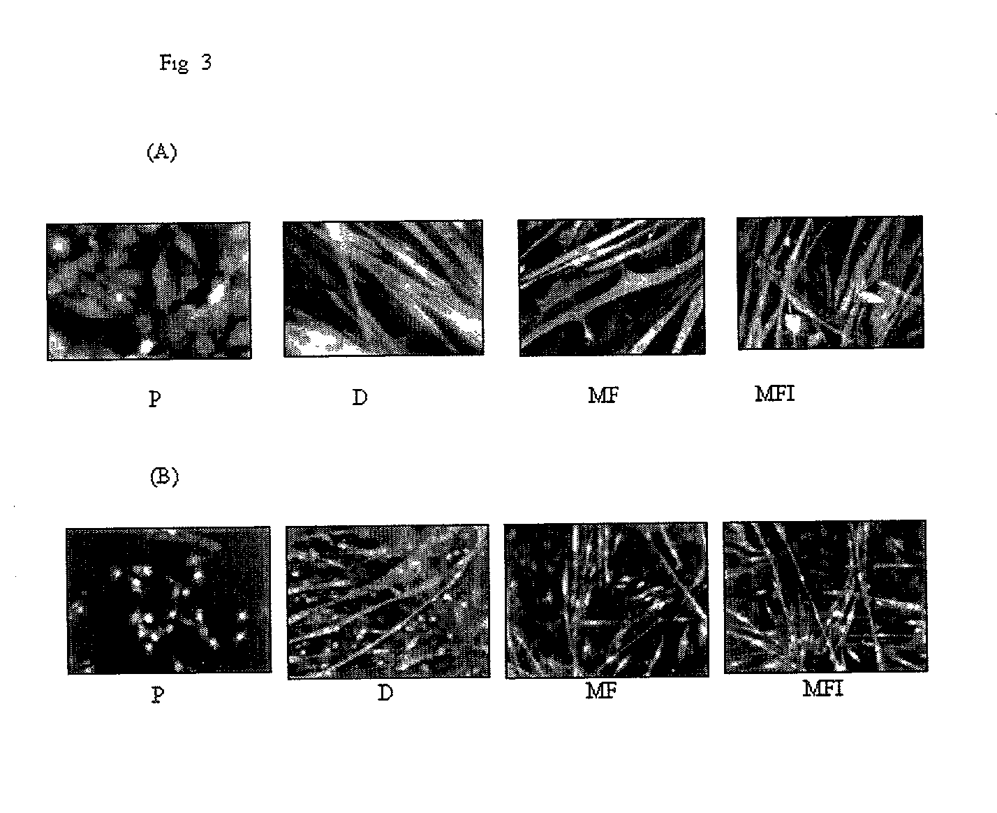 Skeletal cell model to screen anti-diabetic compounds