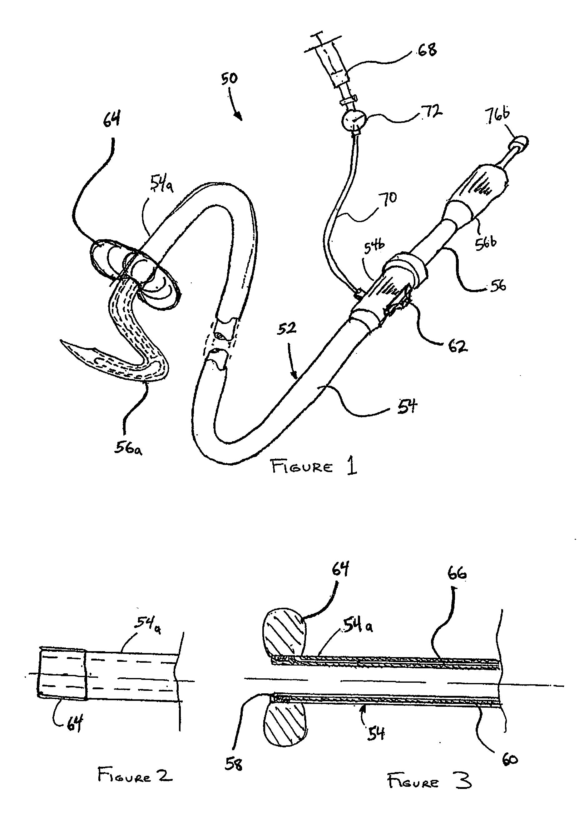 Catheter-based tissue remodeling devices and methods