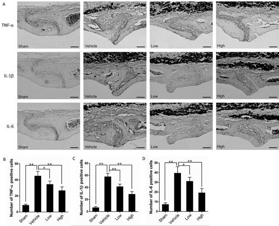 Application of melatonin to preparation of medicine for treating loose periprosthetic chronic inflammation and bone destruction