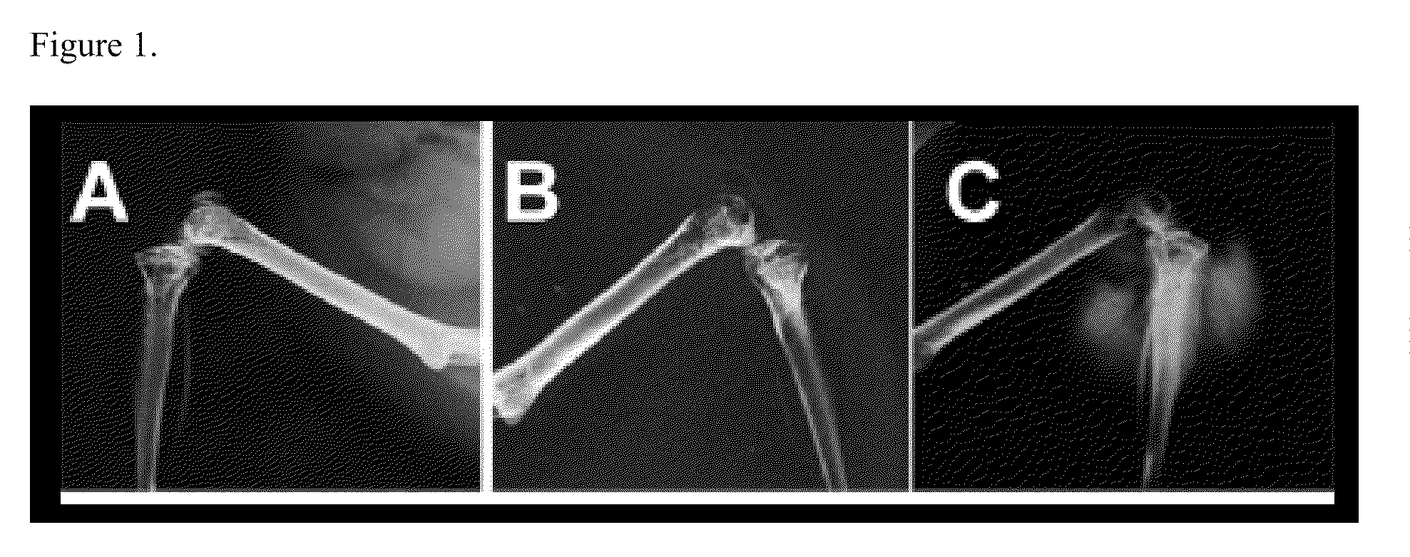 Compositions and Methods For Treating Bone Formation Disorders