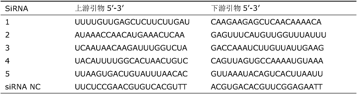 siRNA capable of inhibiting expression of HSP90 gene in breast cancer cells