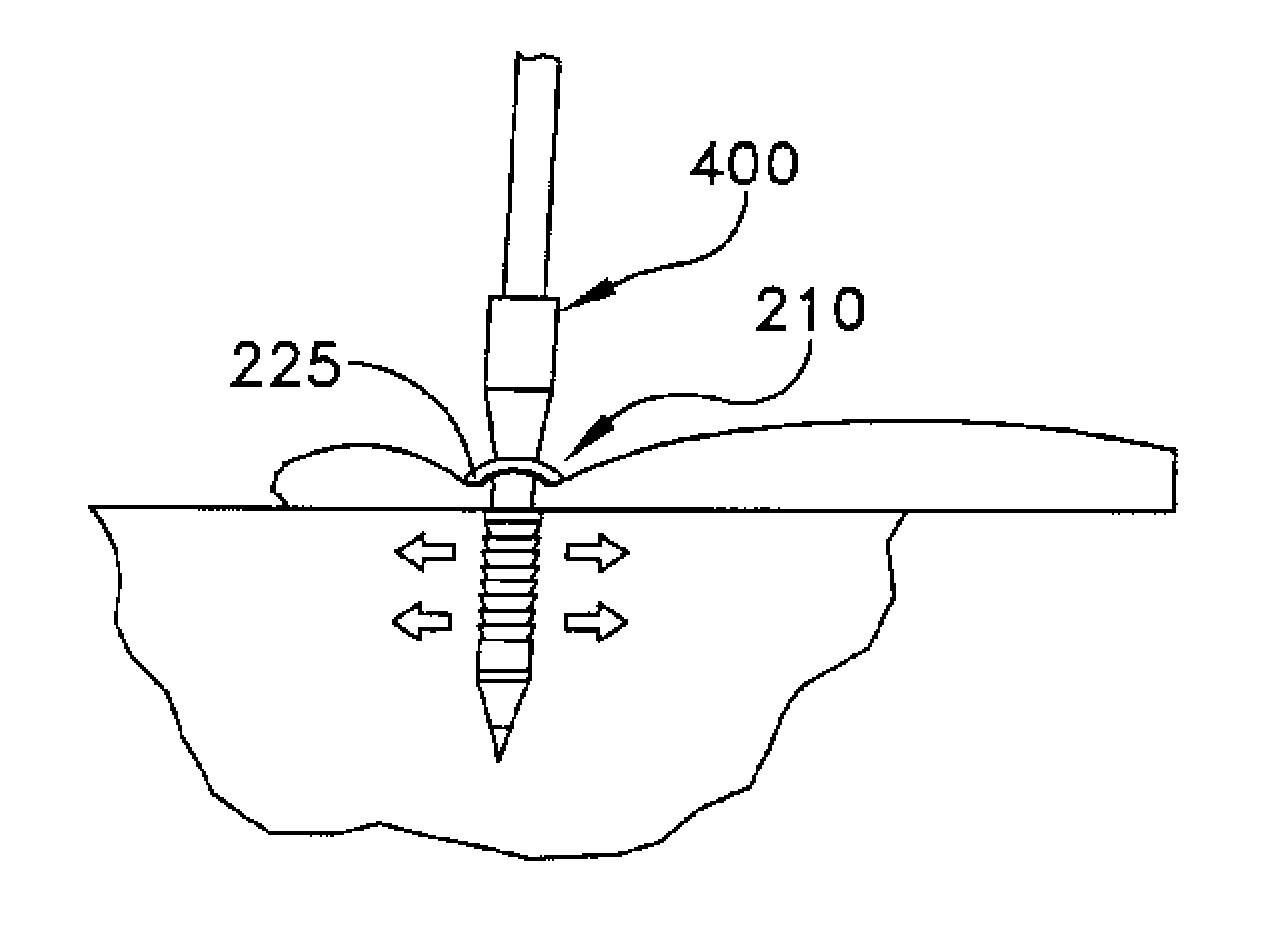 System and method for attaching soft tissue to bone