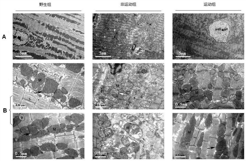 Application of hdac4 inhibitor in preparation of medicine for treating heart failure