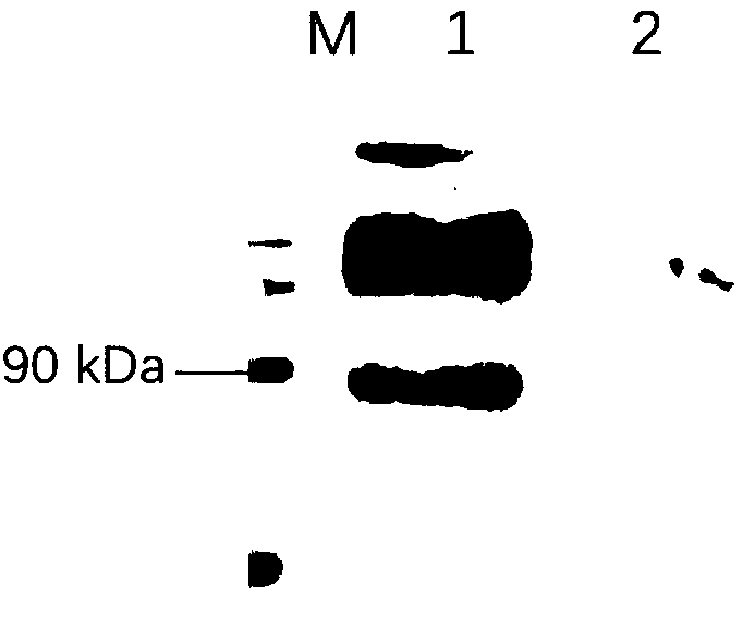 Construction of EP153R and EP402R gene co-expression recombinant adenovirus vector and adenovirus packaging method