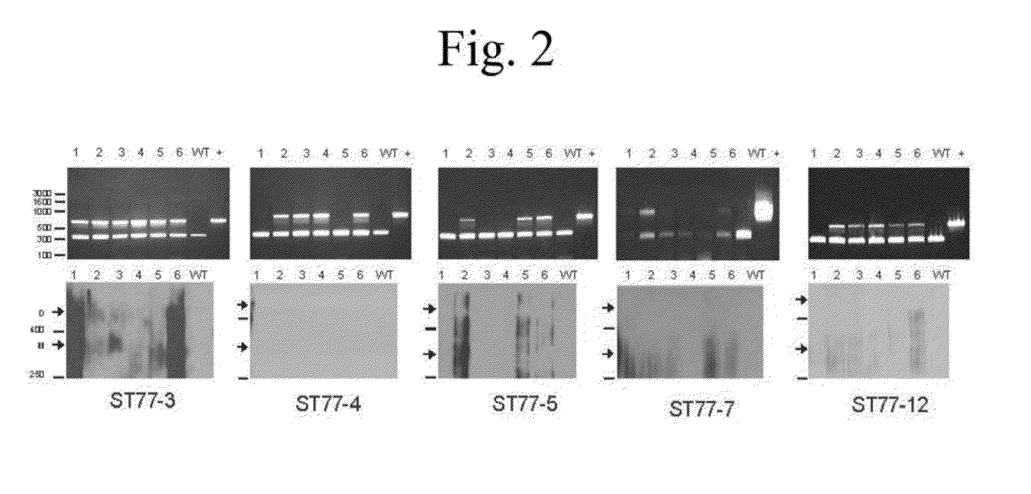 Soybean derived human thyroglobulin, methods of producing and applications thereof