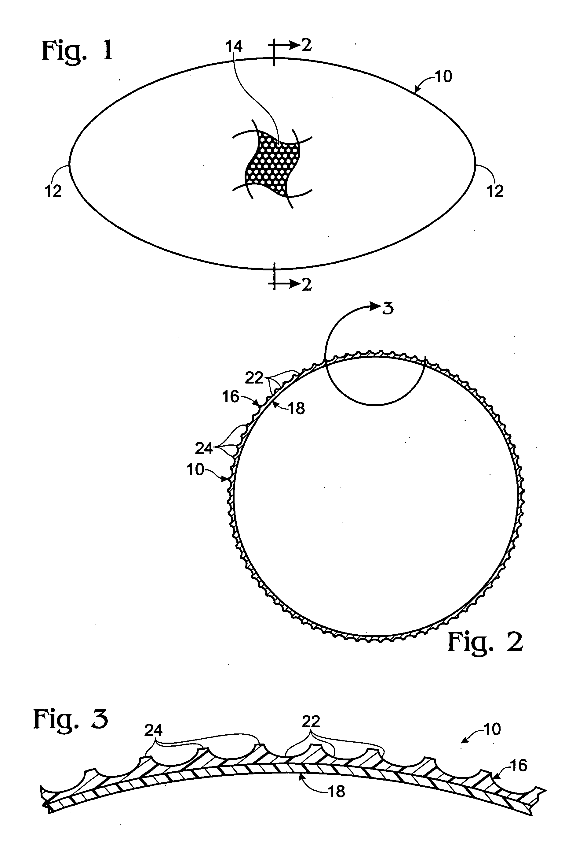 Football with a modified surface conferring altered aerodynamic properties