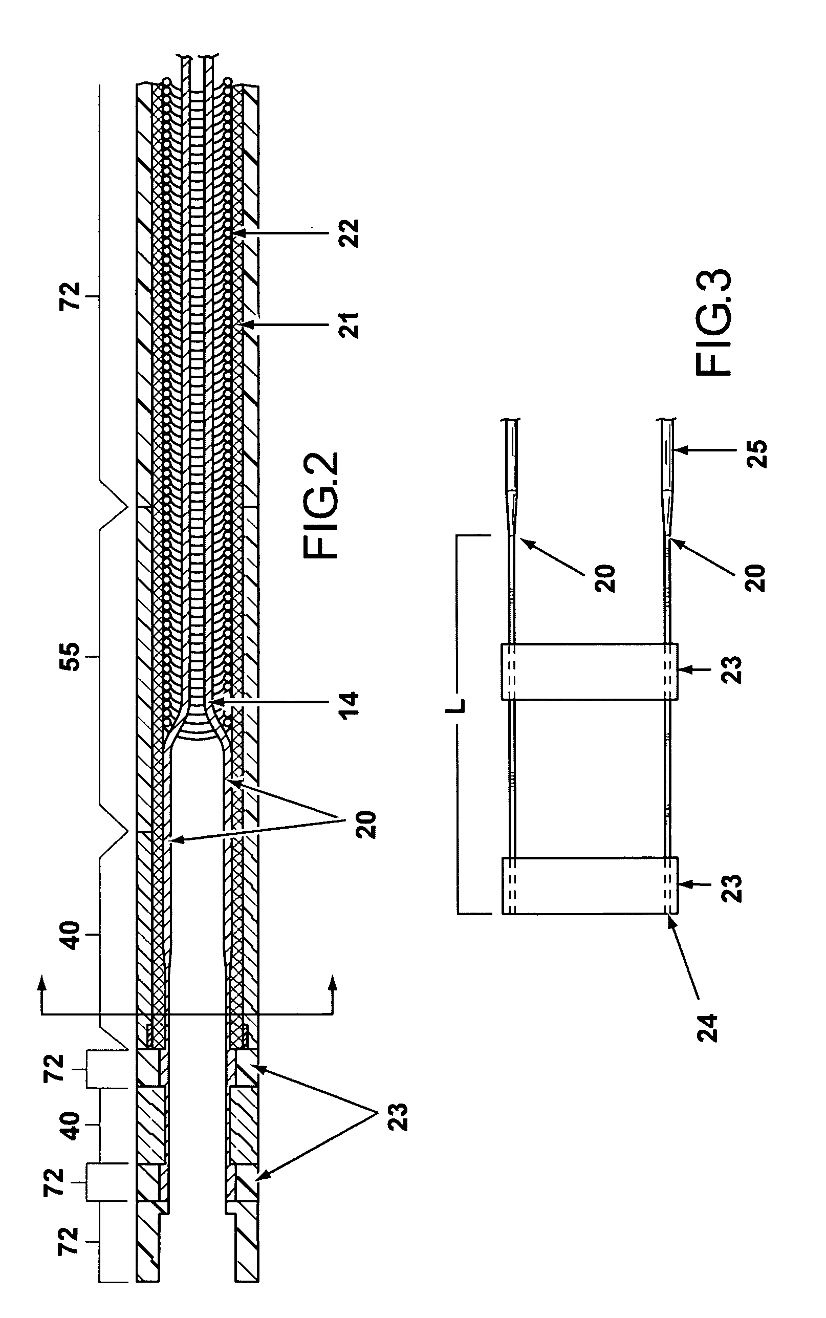 Deflectable variable radius catheters