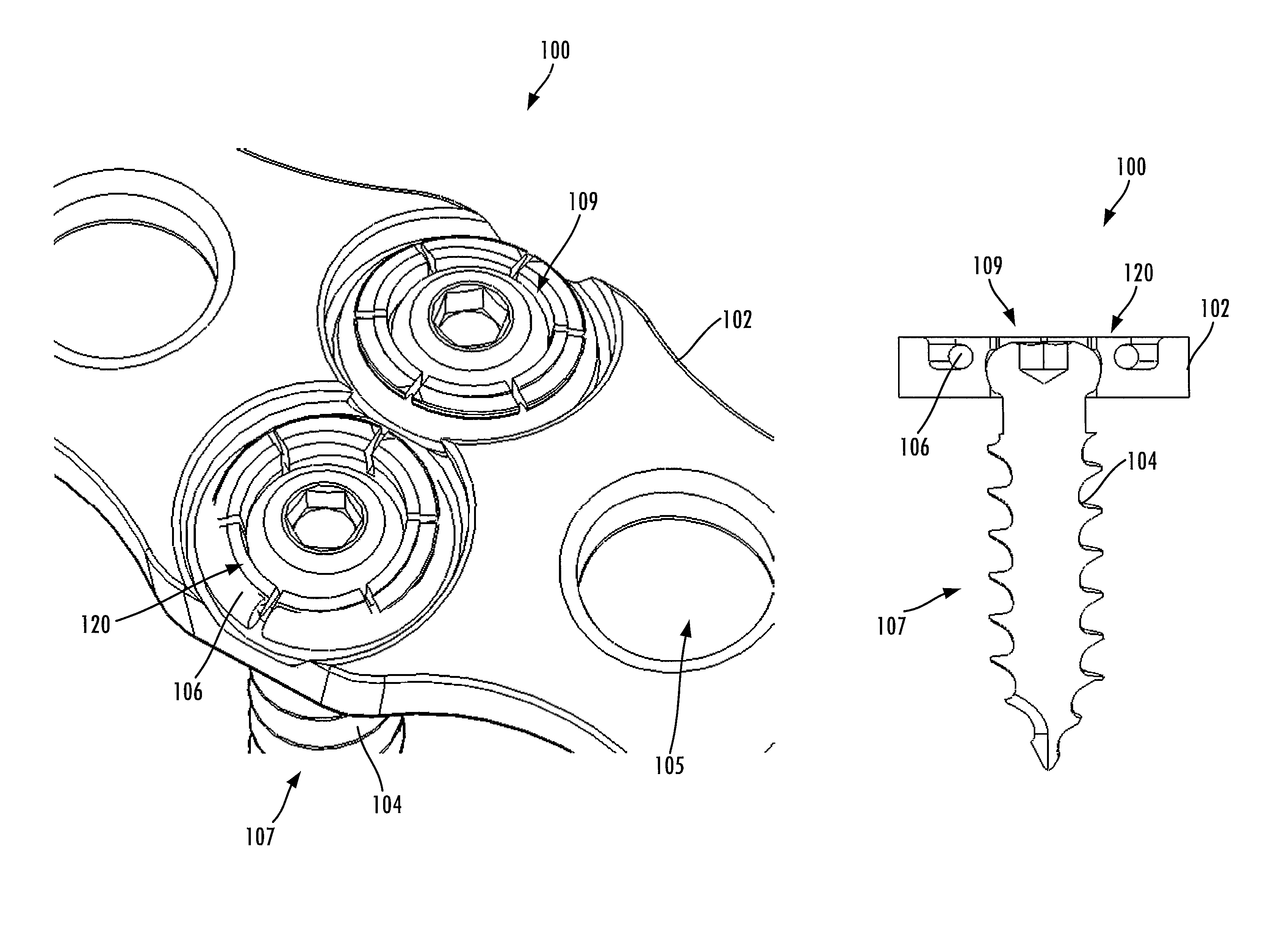 Cervical plate locking mechanism and associated surgical method