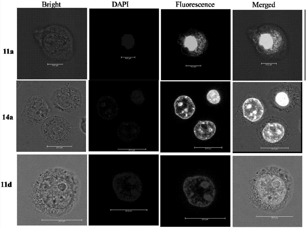 Targeted estrogen receptor fluorescent probes and preparation and usage methods thereof