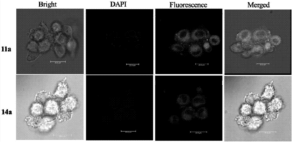 Targeted estrogen receptor fluorescent probes and preparation and usage methods thereof