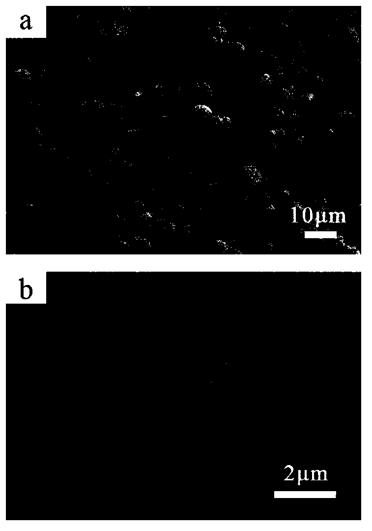 Preparation method of hydroxyapatite microspheres