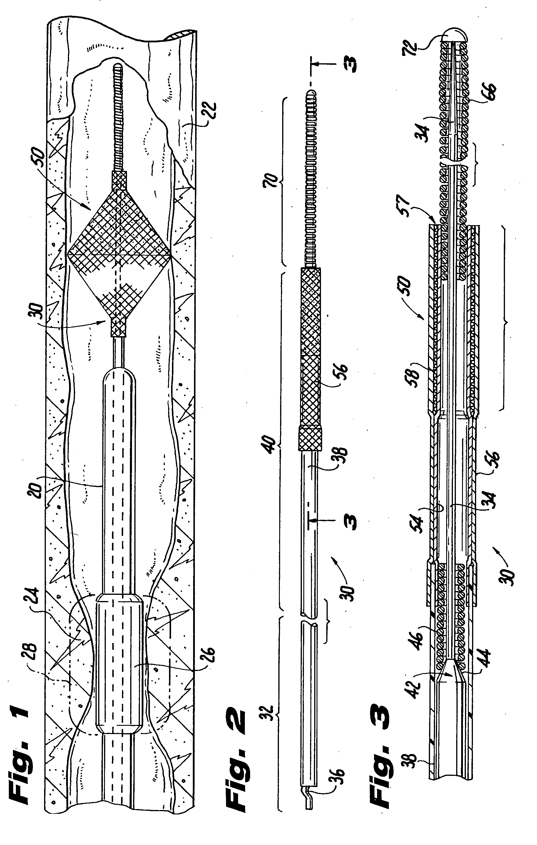 Temporary vascular filter guide wire