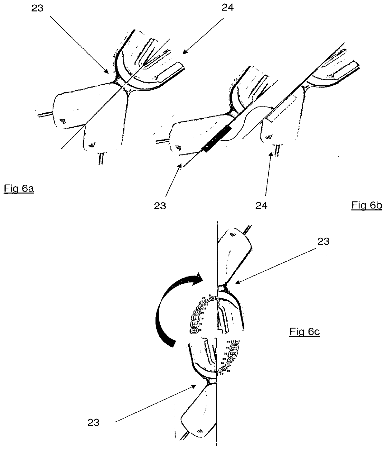 Electronic impression tray for obtaining dental information