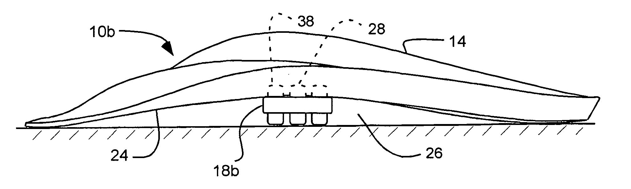 Arch support reinforcement device