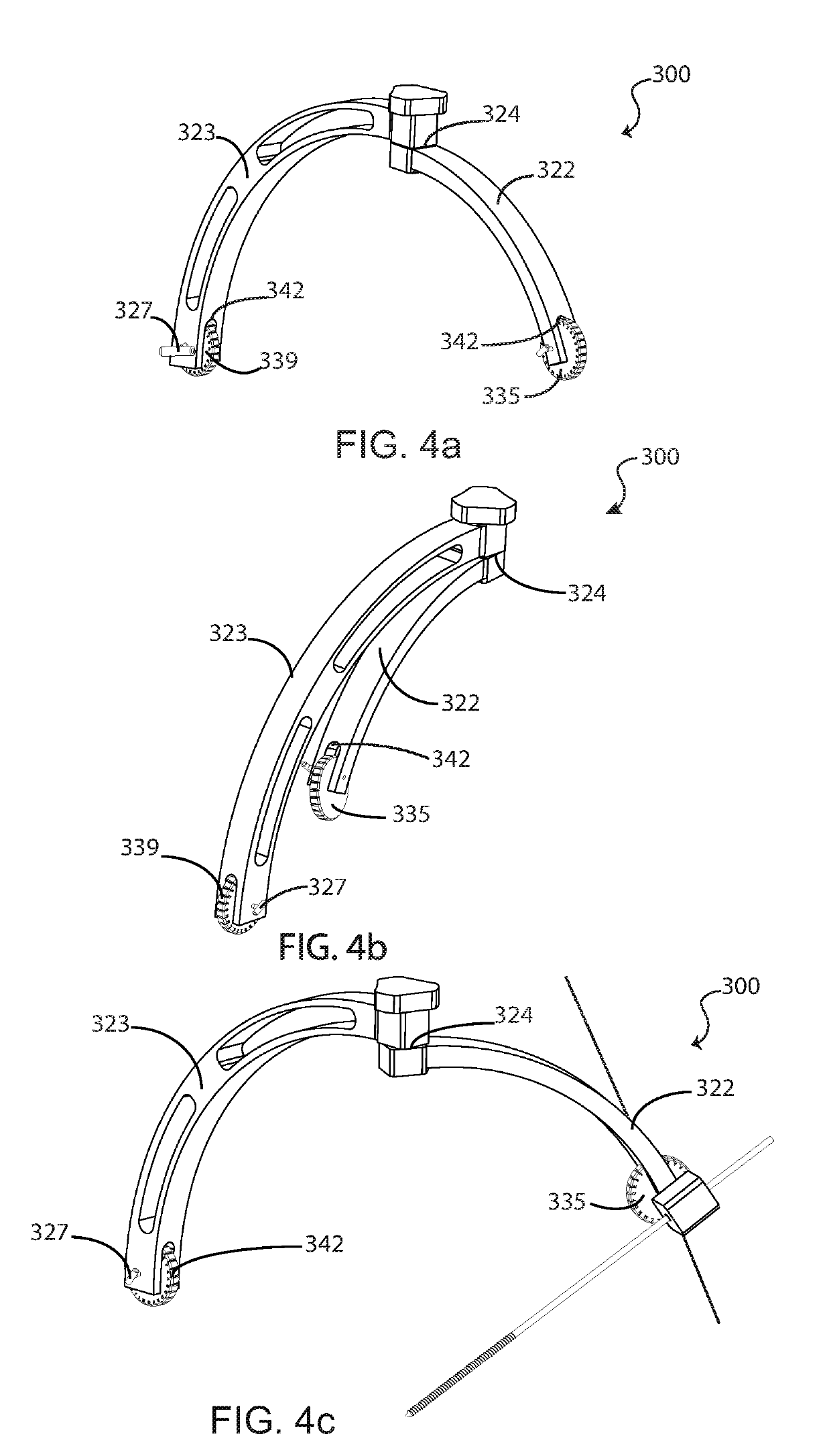 Percutaneous Metatarsal Fixation Guide and Methods of Use