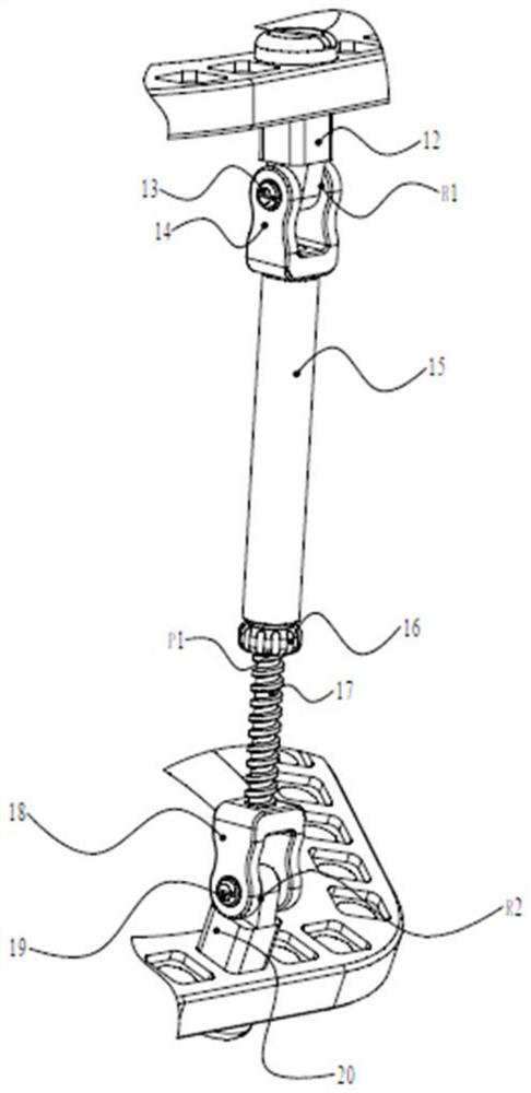 Parallel external fixator system for correcting single-plane malformation of ankle part