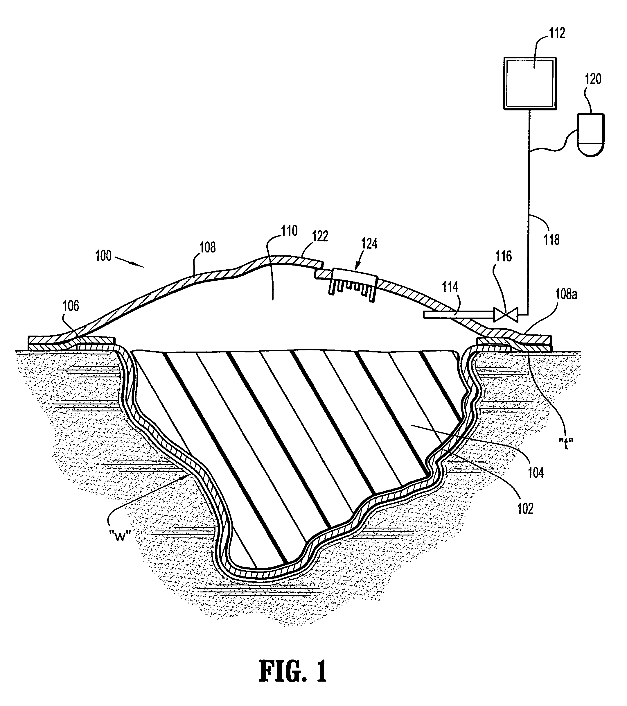 Wound dressing with vacuum reservoir