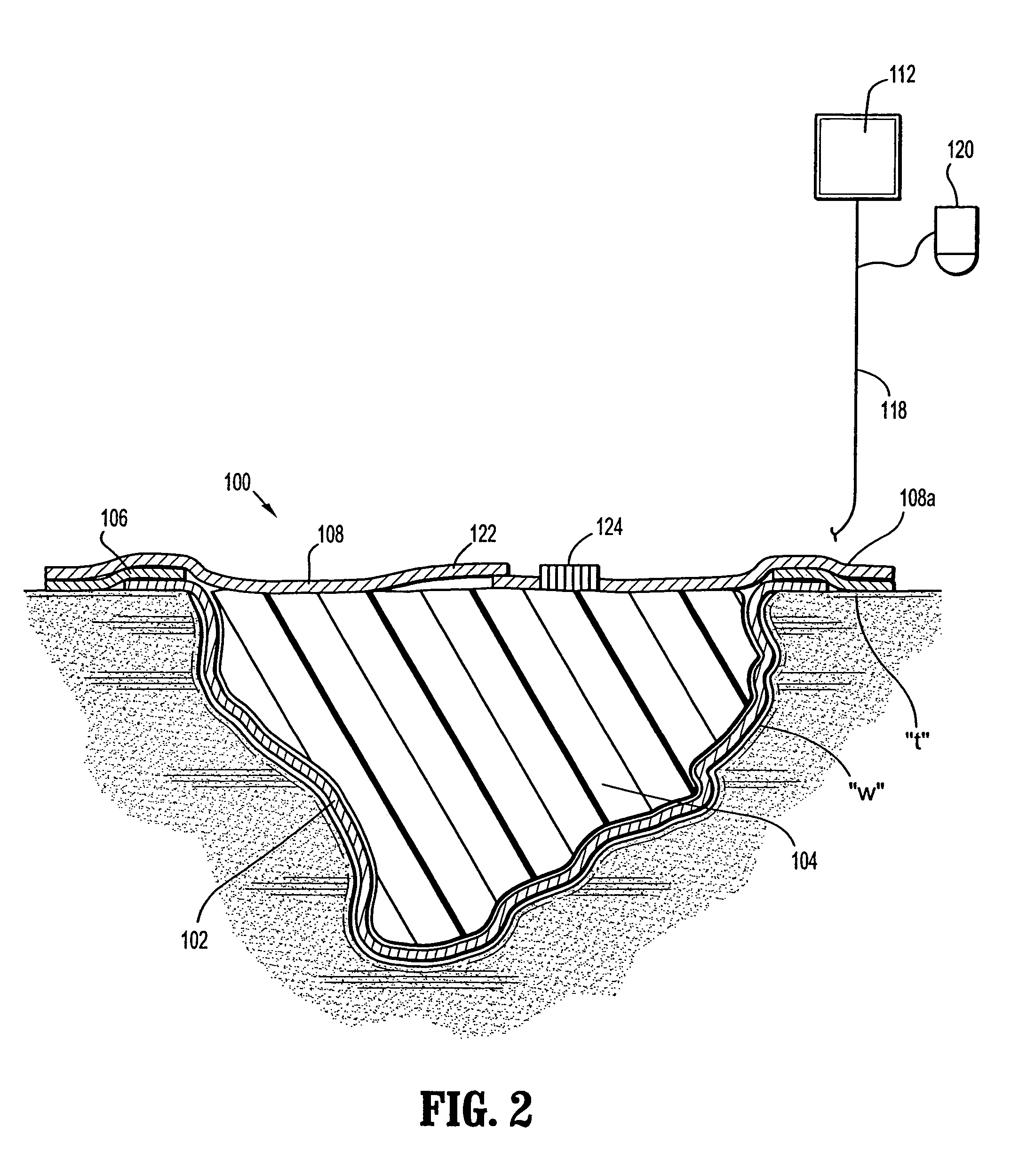 Wound dressing with vacuum reservoir