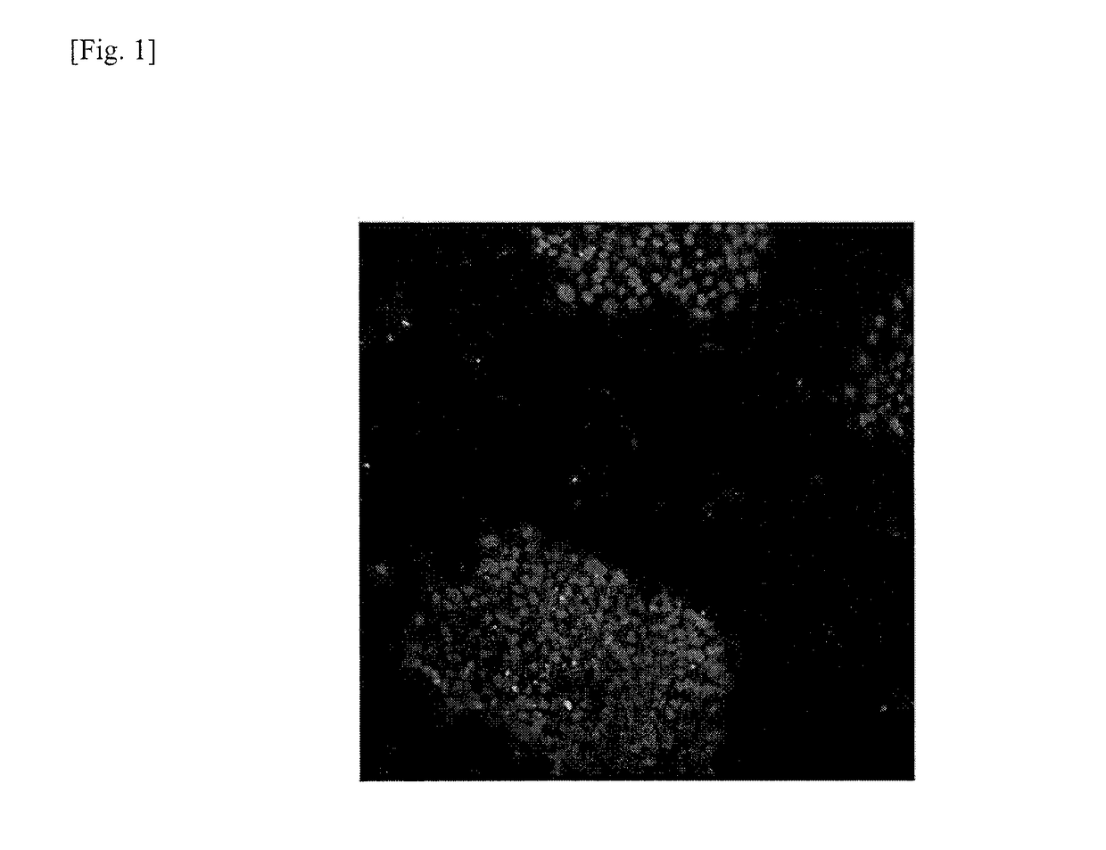 Method for removing genomically unstable IPS cells and synthetic peptide used therefor