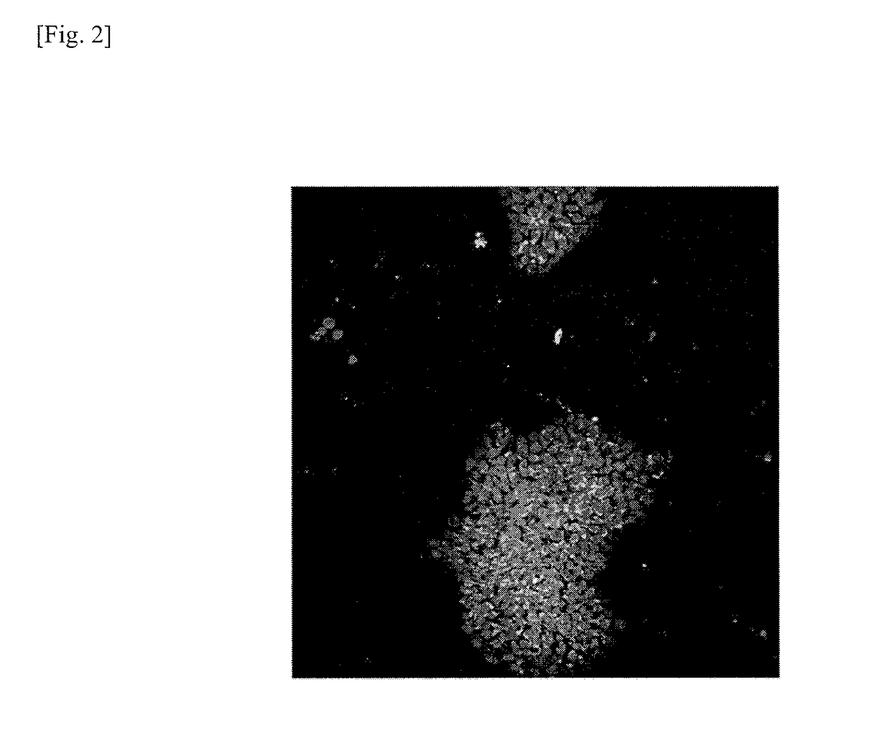 Method for removing genomically unstable IPS cells and synthetic peptide used therefor