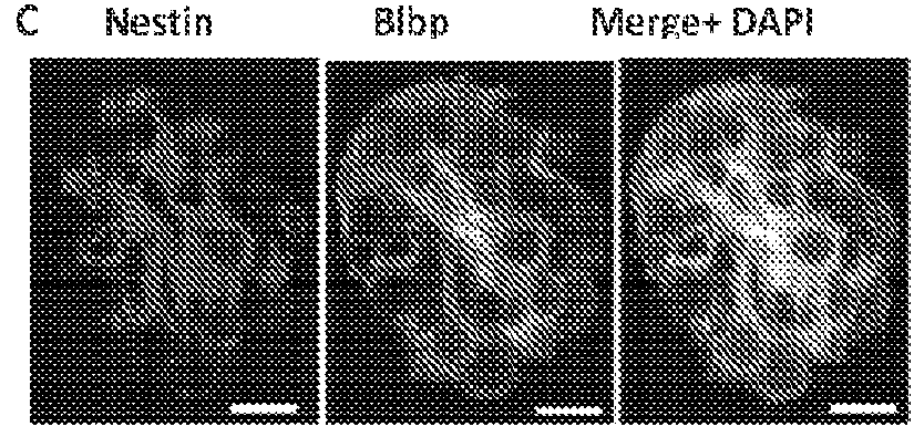 Neural stem cell therapy for obesity and diabetes