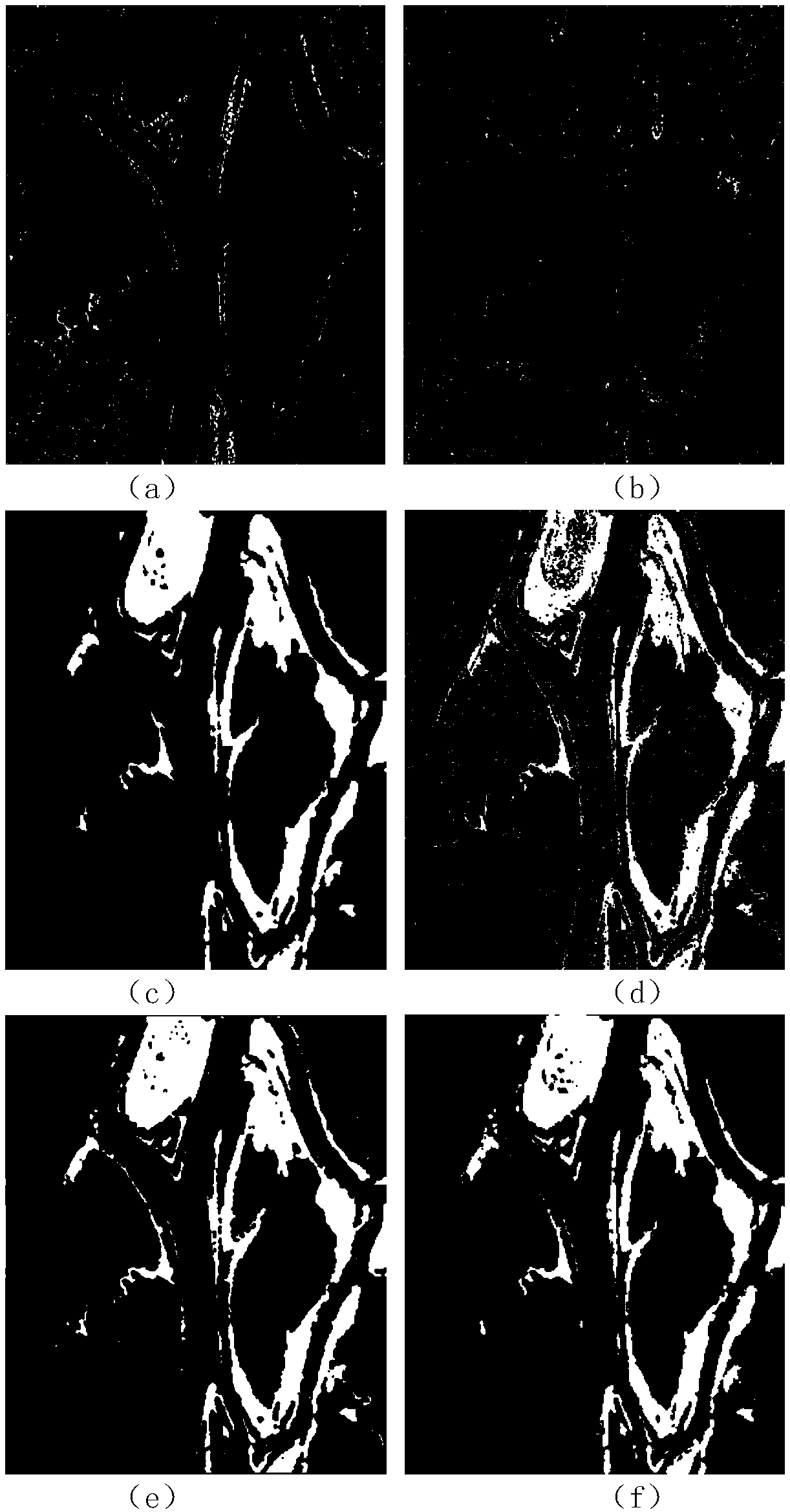 SAR image change detection method based on SPL and CCN