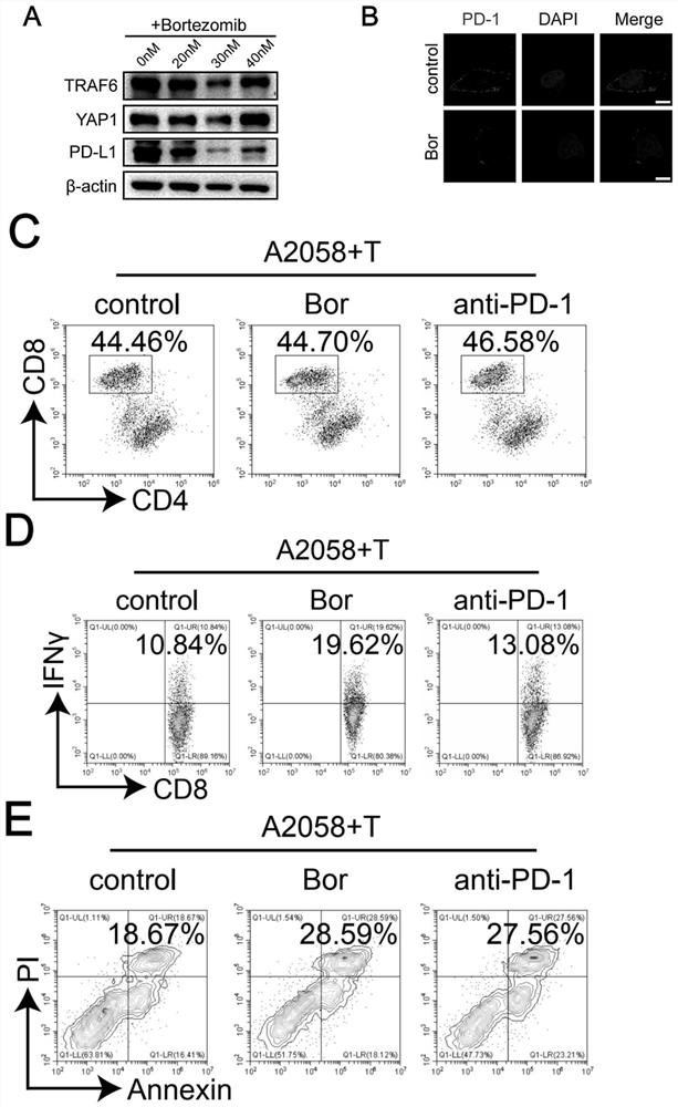 Application of TRAF6 inhibitor in preparation of melanoma drug