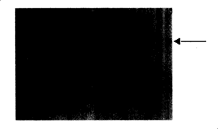 Gene transfer method for promoting insect resistance of soybean