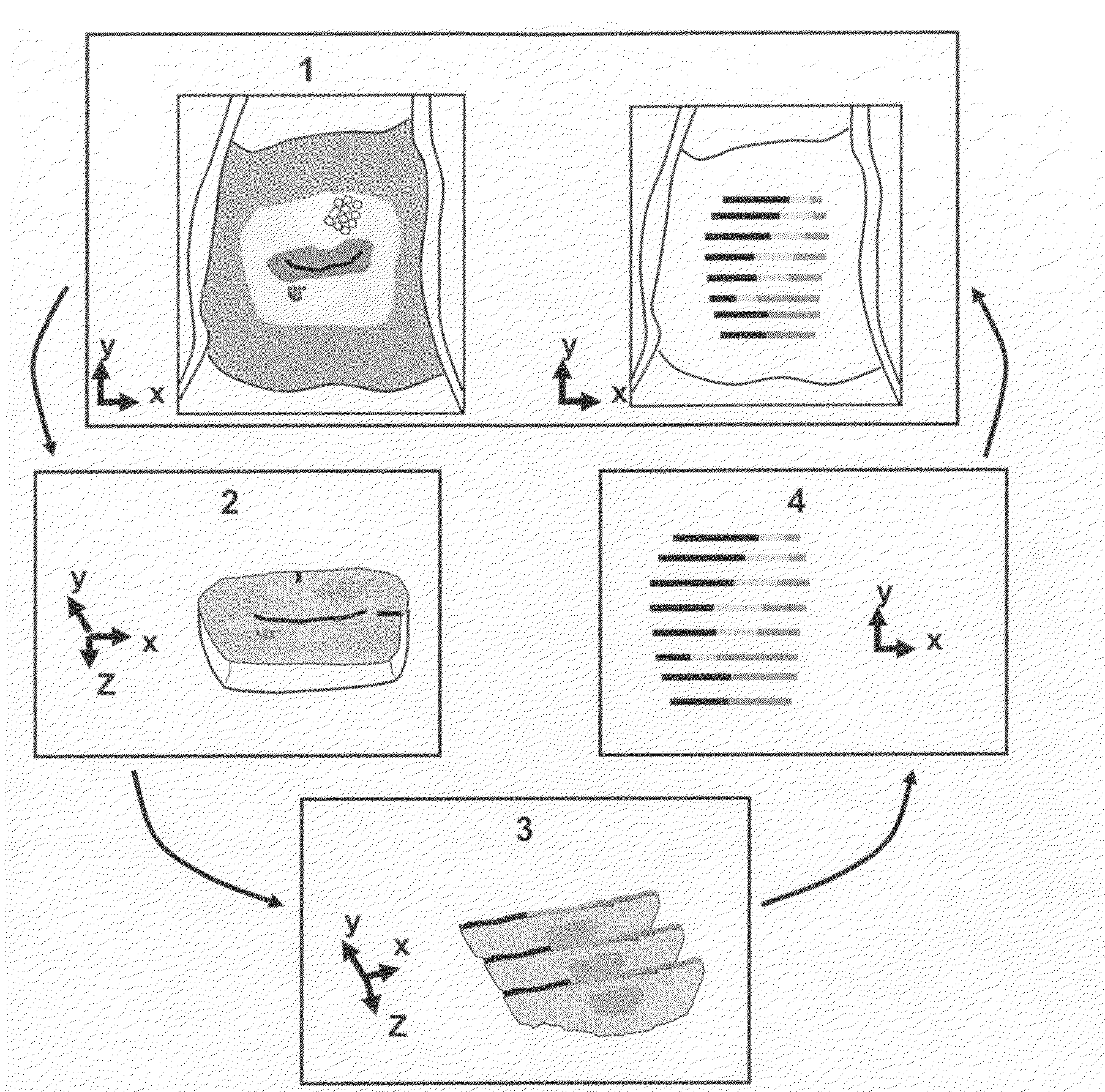 Process for preserving three dimensional orientation to allow registering histopathological diagnoses of tissue to images of that tissue