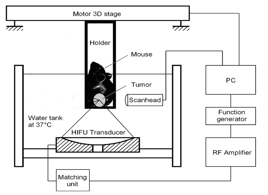 Method for enhancing high intensity focused ultrasound (HIFU) induced anti-tumor immune response