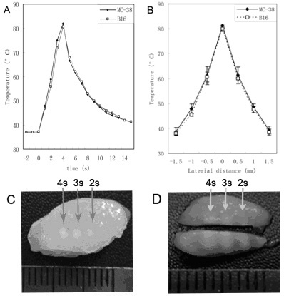 Method for enhancing high intensity focused ultrasound (HIFU) induced anti-tumor immune response