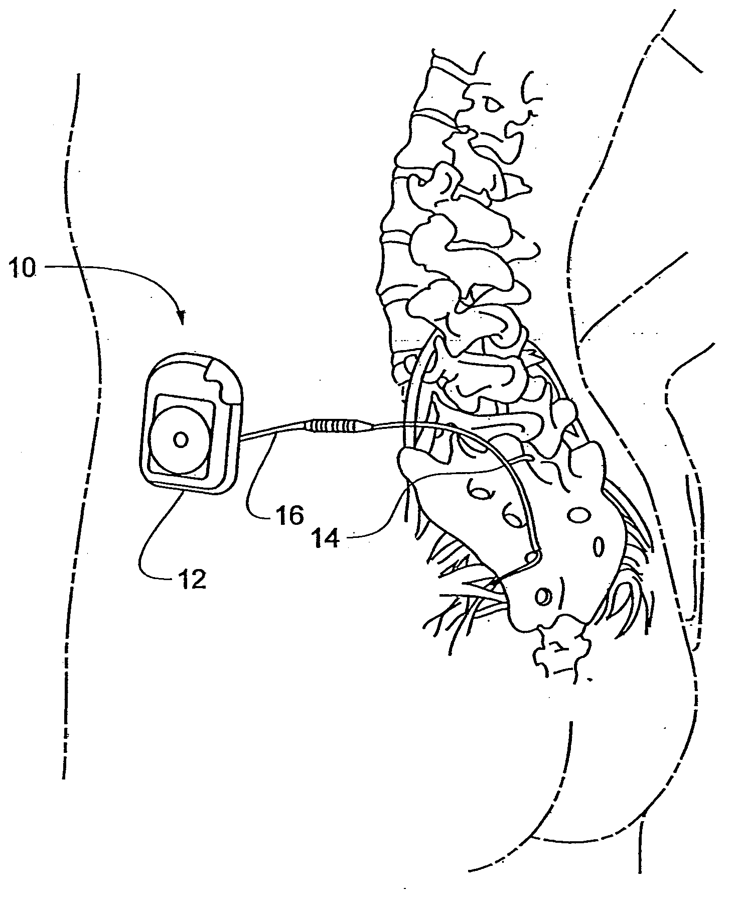 Implantable medical device configured for diagnostic emulation