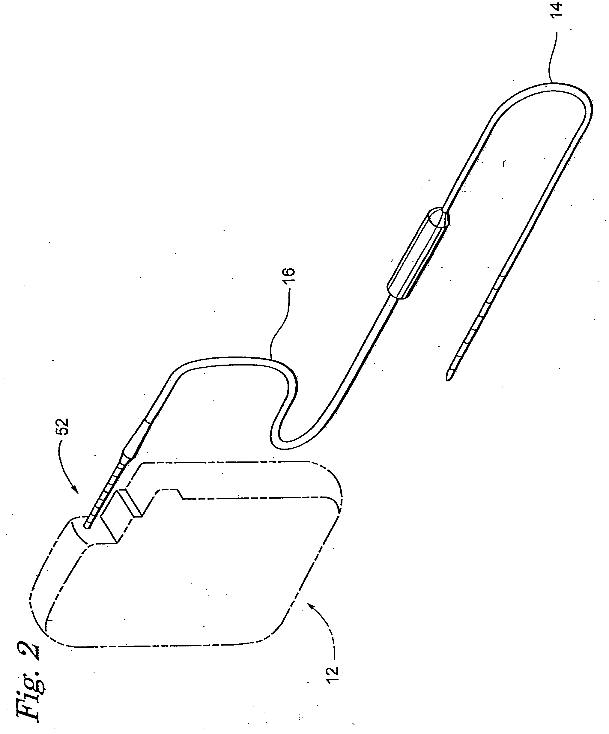 Implantable medical device configured for diagnostic emulation