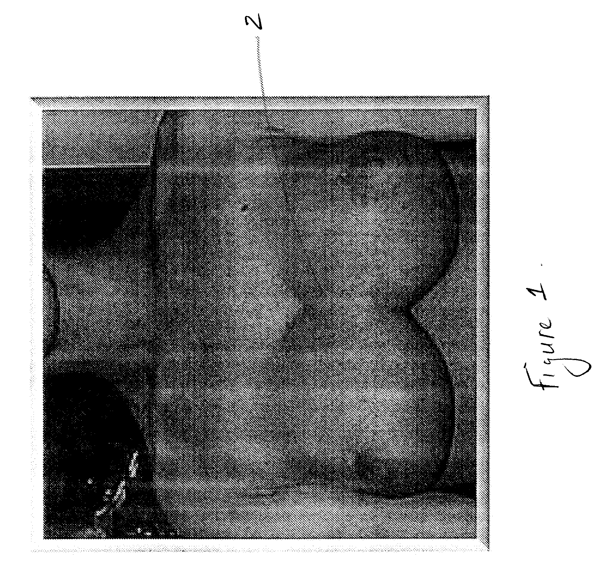 Implantable prosthesis for positioning and supporting a breast implant