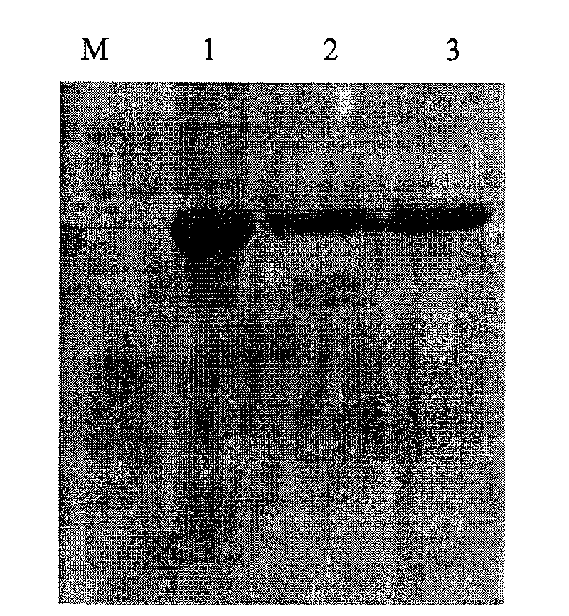 Recombination protein A gene and preparation of expression product thereof