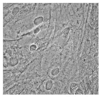 A kind of medium for inducing adipogenic differentiation of skeletal muscle myogenic stem cells and its application and adipogenic differentiation method