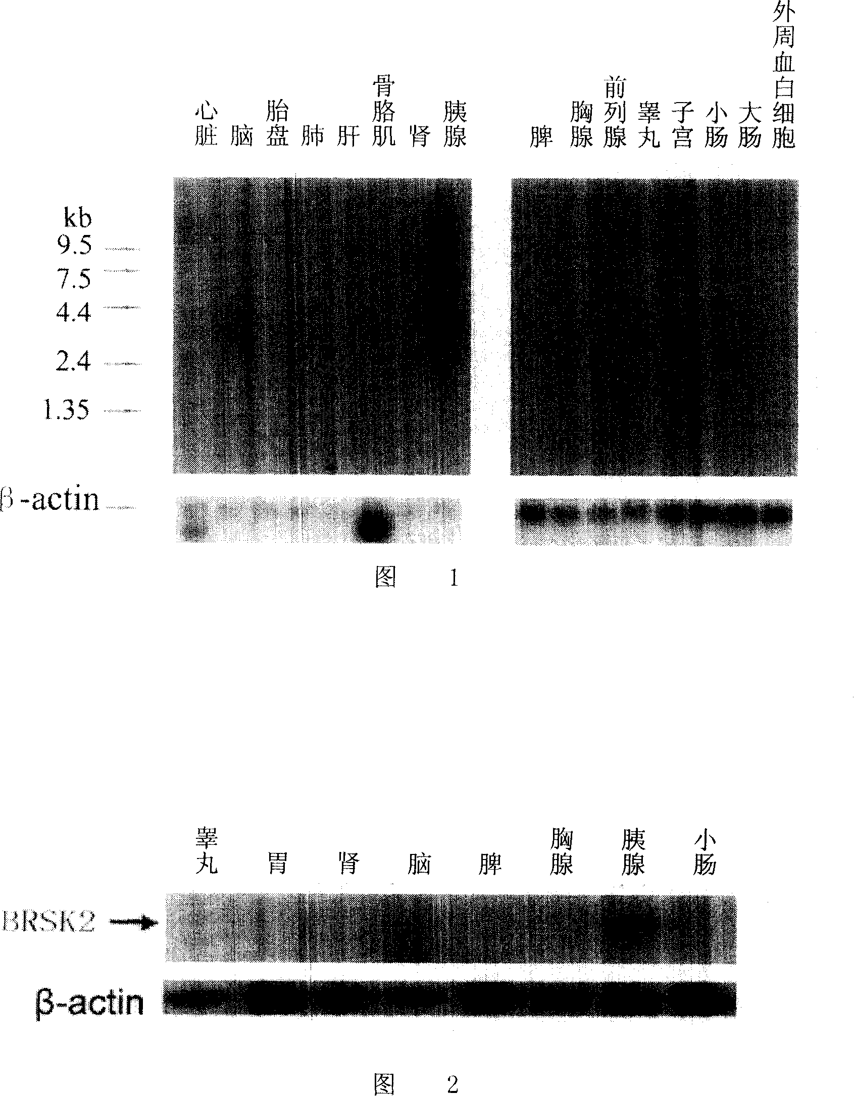 Application of BRSK2 in producing antidiabetic medicine