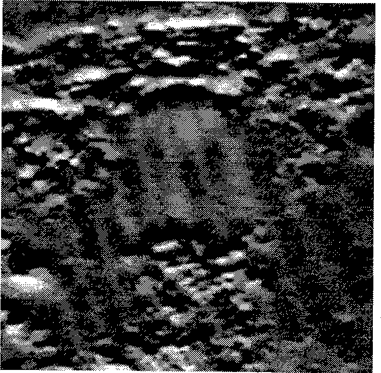 System and method for super-resolution imaging and multi-parameter detection of vascular mechanical characteristic