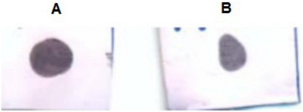 Anti-GRPR antibody, method for producing same, detection method, use of the antibody, kit and gene construct